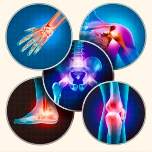 Osteoarthritis physio in Burgess Hill